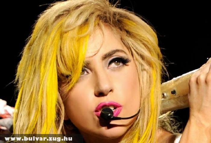 Arany tolószékben lábadozik Lady Gaga
