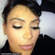 Kim Kardashian akupunktúrázni jár